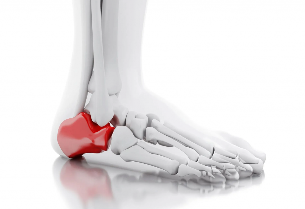 Toe Heel Spur Pain Relief Heel Pain Cream Stiff Arch Pain Relief_b | Fruugo  KR